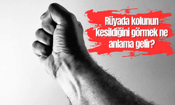 Rüyada kolunun kesildiğini görmek ne anlama gelir?