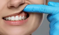 Diş eti çekilmesi sadece estetik değil, Ciddi bir ağız sağlığı sorunu