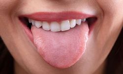 Dilinizi ihmal etmeyin: İlk uyarılar burada başlıyor!