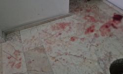 Eskişehir'de üvey oğlu tarafından bıçaklanmıştı: Acı haber geldi