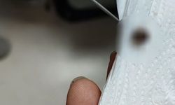 Eskişehir'de 1 aydır kulak ağrısı çekiyordu: Gerçek herkesi şaşırttı