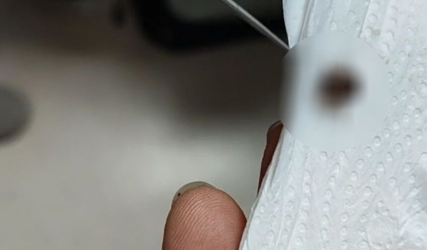 Eskişehir'de 1 aydır kulak ağrısı çekiyordu: Gerçek herkesi şaşırttı